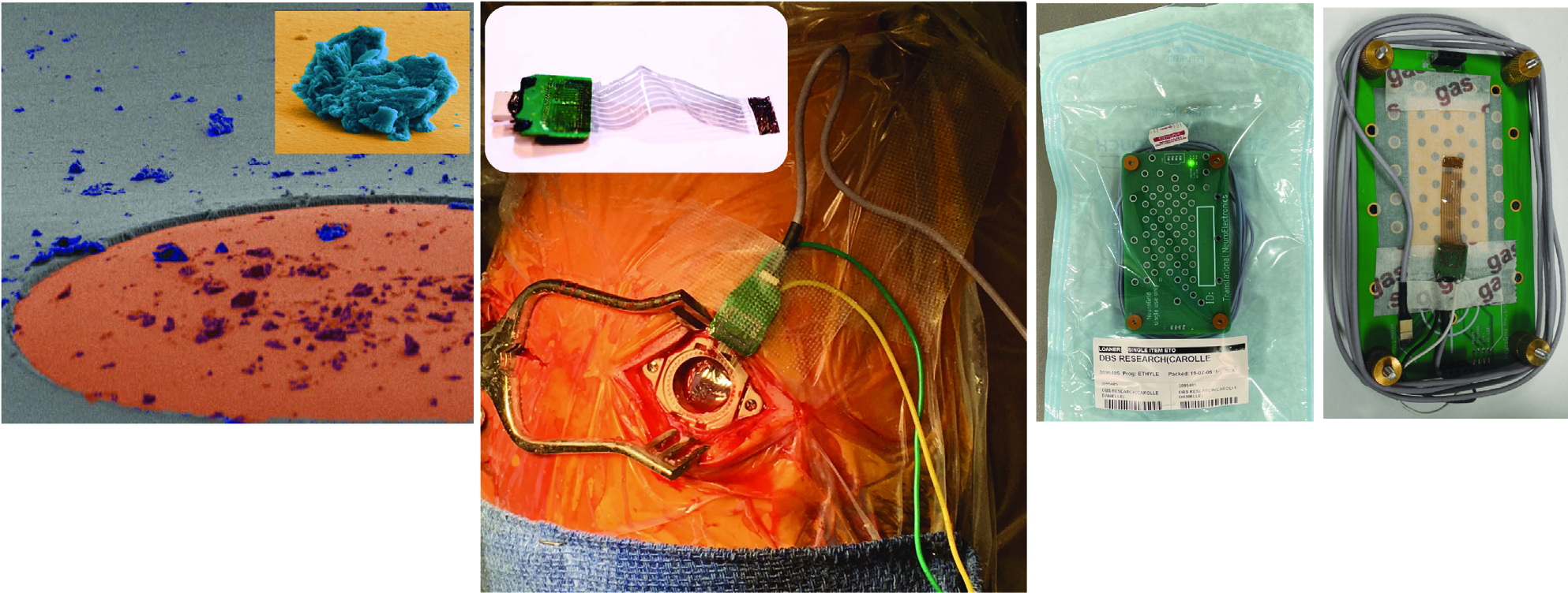 Organic neural interface layouts and device structures for single-neuron resolution.