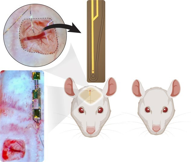 Conformable organic biointerface device panels and implantation views.