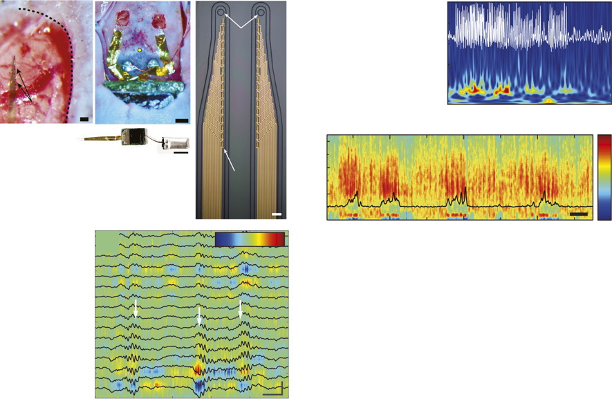 Implantable closed-loop neural interface with device and recording panels.